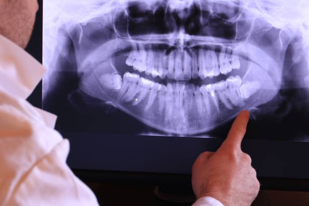 Best Emergency Dentist for Lost Fillings or Crowns in Tracyton, WA